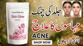 Skin Glow & Acne Support Powder